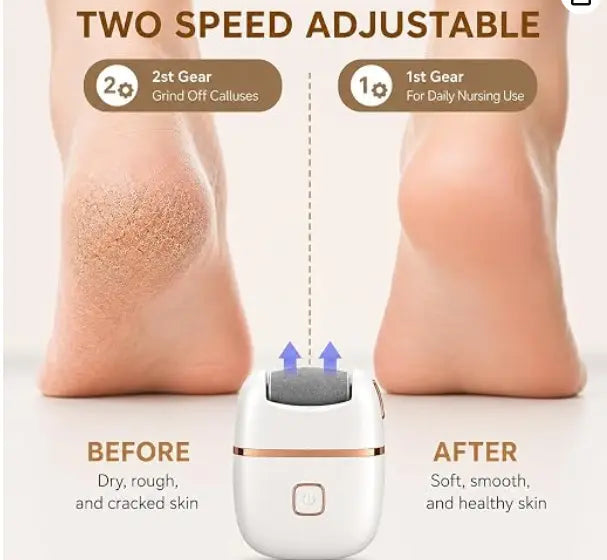 Electric Callus Remover Dropdash