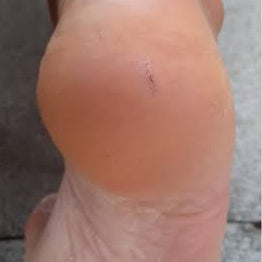 After image